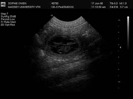Sophie's ultrasound.